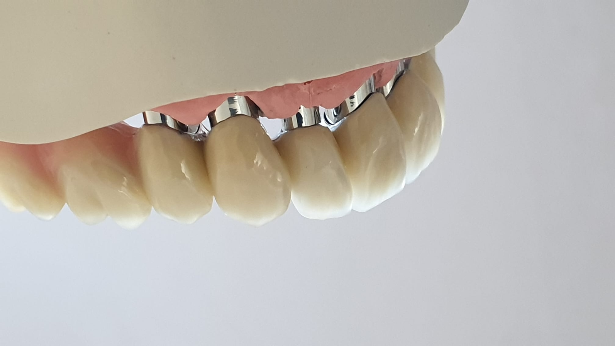 Kombinationstechnik und Feinarbeit